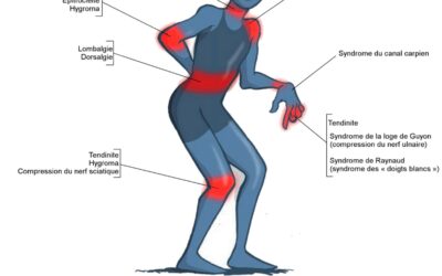 096- Les troubles musculo-squelettiques